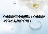 心電監(jiān)護(hù)三個電極貼（心電監(jiān)護(hù)3個怎么貼簡介介紹）