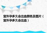 宮外孕多久會(huì)出血顏色及圖片（宮外孕多久會(huì)出血）