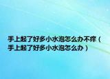 手上起了好多小水泡怎么辦不癢（手上起了好多小水泡怎么辦）