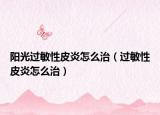 陽光過敏性皮炎怎么治（過敏性皮炎怎么治）