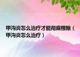 甲溝炎怎么治療才能徹底根除（甲溝炎怎么治療）