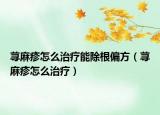 蕁麻疹怎么治療能除根偏方（蕁麻疹怎么治療）