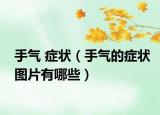 手氣 癥狀（手氣的癥狀圖片有哪些）