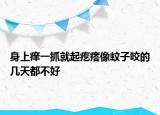 身上癢一抓就起疙瘩像蚊子咬的幾天都不好