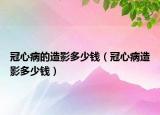冠心病的造影多少錢（冠心病造影多少錢）