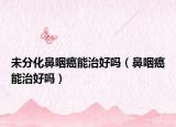 未分化鼻咽癌能治好嗎（鼻咽癌能治好嗎）