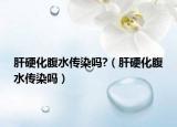 肝硬化腹水傳染嗎?（肝硬化腹水傳染嗎）