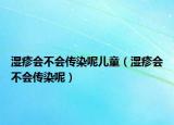 濕疹會不會傳染呢兒童（濕疹會不會傳染呢）