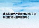 皮膚過敏用蘆薈膠可以嗎?（皮膚過敏可以用蘆薈膠嗎）