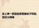 身上癢一抓就起疙瘩像蚊子咬的,抓好火辣辣
