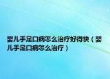 嬰兒手足口病怎么治療好得快（嬰兒手足口病怎么治療）