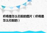 疥瘡是怎么引起的圖片（疥瘡是怎么引起的）