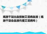 嘴唇干裂出血接觸艾滋病血液（嘴唇干裂會血液傳播艾滋病嗎）