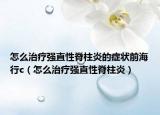 怎么治療強直性脊柱炎的癥狀前海行c（怎么治療強直性脊柱炎）