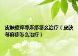 皮膚瘙癢蕁麻疹怎么治療（皮膚蕁麻疹怎么治療）