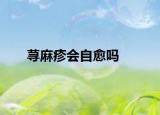 蕁麻疹會自愈嗎