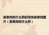 鼻息肉吃什么藥好得快鼻息肉圖片（鼻息肉吃什么藥）