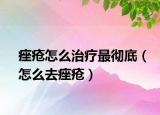 痤瘡怎么治療最徹底（怎么去痤瘡）