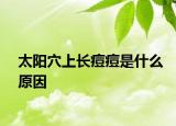 太陽(yáng)穴上長(zhǎng)痘痘是什么原因