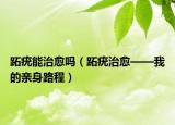 跖疣能治愈嗎（跖疣治愈——我的親身路程）