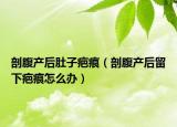 剖腹產(chǎn)后肚子疤痕（剖腹產(chǎn)后留下疤痕怎么辦）