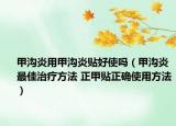 甲溝炎用甲溝炎貼好使嗎（甲溝炎最佳治療方法 正甲貼正確使用方法）