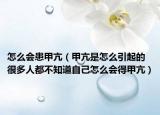 怎么會(huì)患甲亢（甲亢是怎么引起的 很多人都不知道自己怎么會(huì)得甲亢）