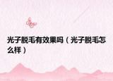 光子脫毛有效果嗎（光子脫毛怎么樣）