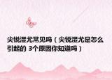 尖銳濕尤常見嗎（尖銳濕尤是怎么引起的 3個(gè)原因你知道嗎）