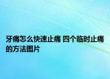 牙痛怎么快速止痛 四個臨時止痛的方法圖片