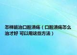 怎樣能治口腔潰瘍（口腔潰瘍怎么治才好 可以用這些方法）