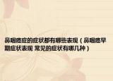 鼻咽癌癥的癥狀都有哪些表現(xiàn)（鼻咽癌早期癥狀表現(xiàn) 常見的癥狀有哪幾種）