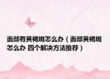 面部有黃褐斑怎么辦（面部黃褐斑怎么辦 四個解決方法推薦）