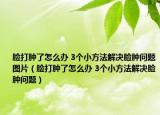 臉打腫了怎么辦 3個小方法解決臉腫問題圖片（臉打腫了怎么辦 3個小方法解決臉腫問題）