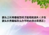 額頭上長(zhǎng)青春痘怎樣才能徹底消失（少女額頭長(zhǎng)青春痘怎么辦平時(shí)必須注意清潔）