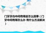 門牙牙齒中間有縫是怎么回事（門牙中間有縫怎么辦 有什么方法解決）