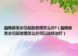 扁桃體發(fā)炎引起的發(fā)燒怎么辦?（扁桃體發(fā)炎引起發(fā)燒怎么辦可以這樣治療）