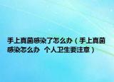 手上真菌感染了怎么辦（手上真菌感染怎么辦  個(gè)人衛(wèi)生要注意）