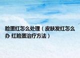 臉蛋紅怎么處理（皮膚發(fā)紅怎么辦 紅臉蛋治療方法）