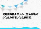 男的眉毛稀少怎么辦（男生眉毛稀少怎么辦眉毛少怎么長眉毛）