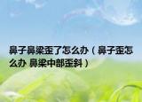 鼻子鼻梁歪了怎么辦（鼻子歪怎么辦 鼻梁中部歪斜）