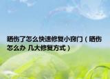 曬傷了怎么快速修復(fù)小竅門（曬傷怎么辦 幾大修復(fù)方式）