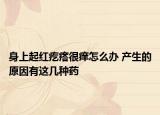 身上起紅疙瘩很癢怎么辦 產(chǎn)生的原因有這幾種藥
