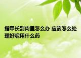 指甲長(zhǎng)到肉里怎么辦 應(yīng)該怎么處理好呢用什么藥