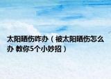太陽曬傷咋辦（被太陽曬傷怎么辦 教你5個小妙招）