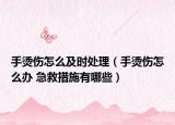 手燙傷怎么及時處理（手燙傷怎么辦 急救措施有哪些）