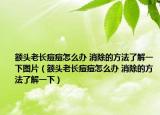 額頭老長痘痘怎么辦 消除的方法了解一下圖片（額頭老長痘痘怎么辦 消除的方法了解一下）