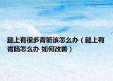 腿上有很多青筋該怎么辦（腿上有青筋怎么辦 如何改善）