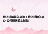 臉上過敏該怎么治（臉上過敏怎么辦 如何預防臉上過敏）