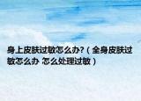 身上皮膚過敏怎么辦?（全身皮膚過敏怎么辦 怎么處理過敏）